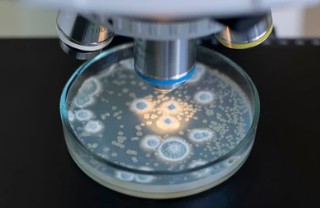 Detection of Bacterial Spores