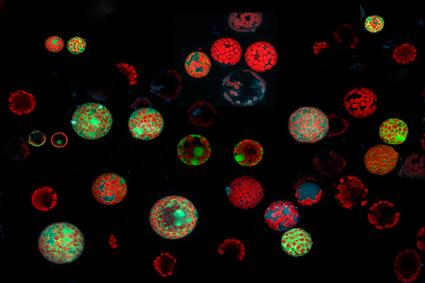 Gene Function Analysis