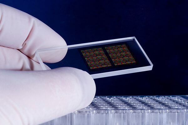 Gene Expression Profiling