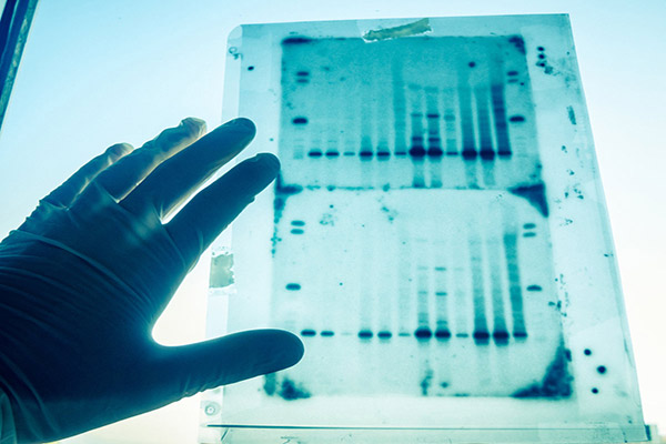 Gene Function Analysis