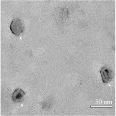 Figure 1. Electron-microscopic observation of milk exosomes. (Zhong et al. 2021)